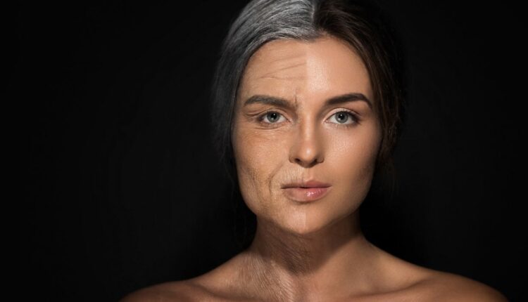Envelhecimento da pele.